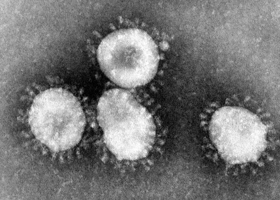 Top five tips to survive the coronavirus